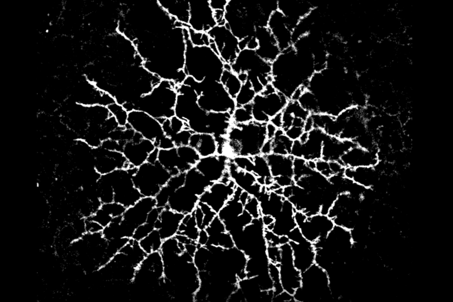 dendrites