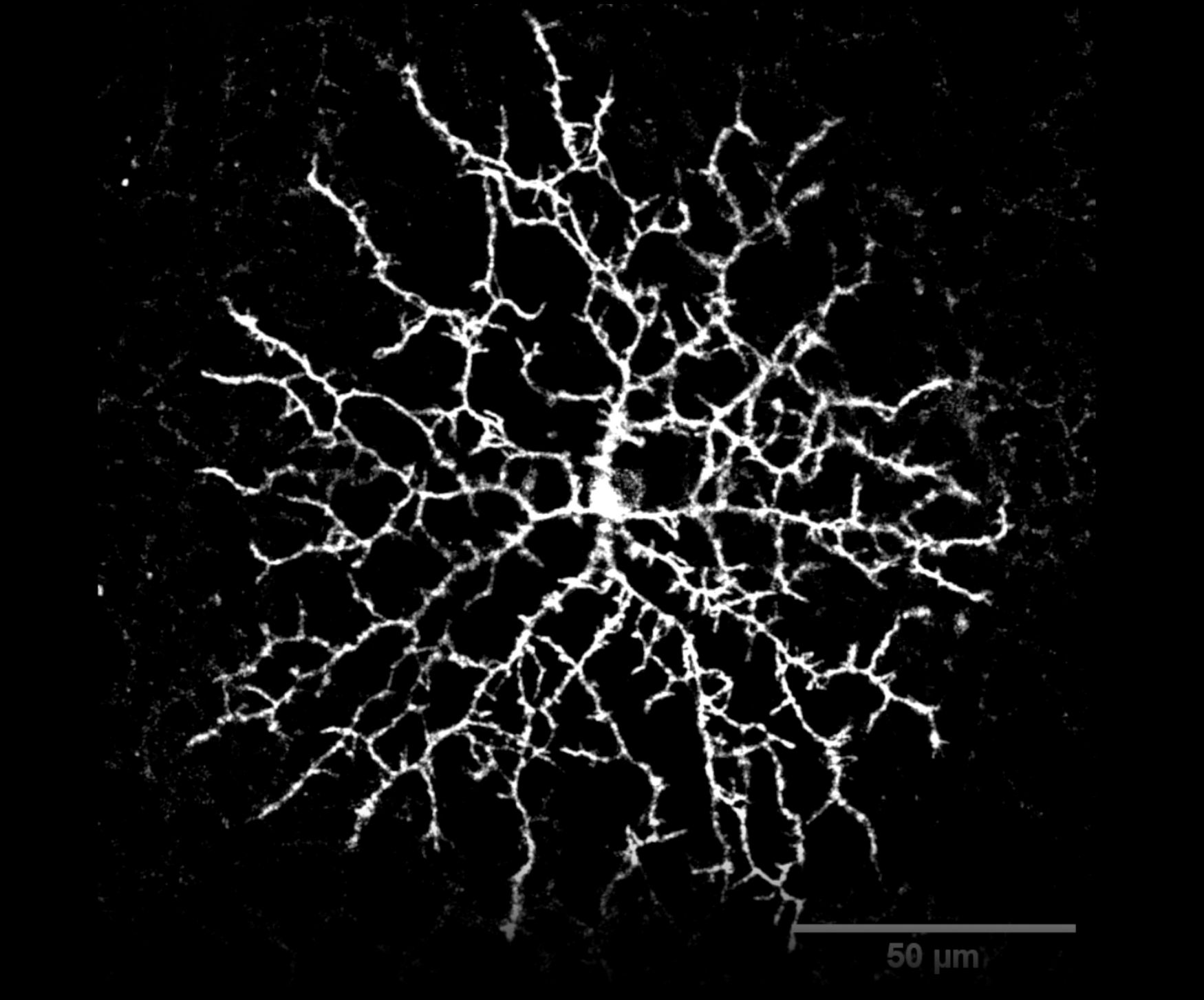 dendrites